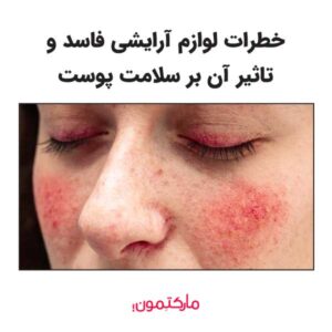 خطرات لوازم آرایشی فاسد و تاثیر آن بر سلامت پوست