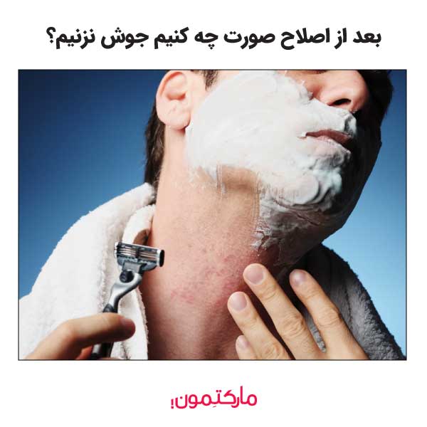 بعد از اصلاح صورت چه کنیم جوش نزنیم؟
