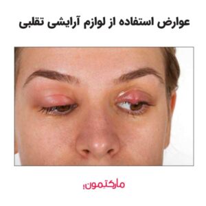 عوارض استفاده از لوازم آرایشی تقلبی