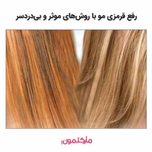 8 مورد از بهترین روش‌های رفع قرمزی مو