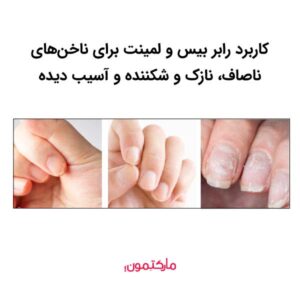 شباهت های رابر بیس و لمینت چیست؟
