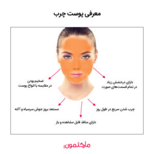پوست چرب