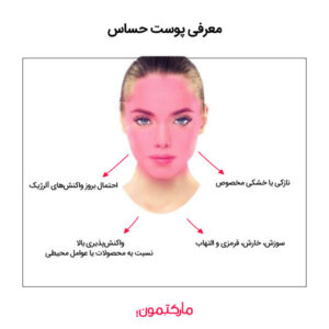پوست حساس